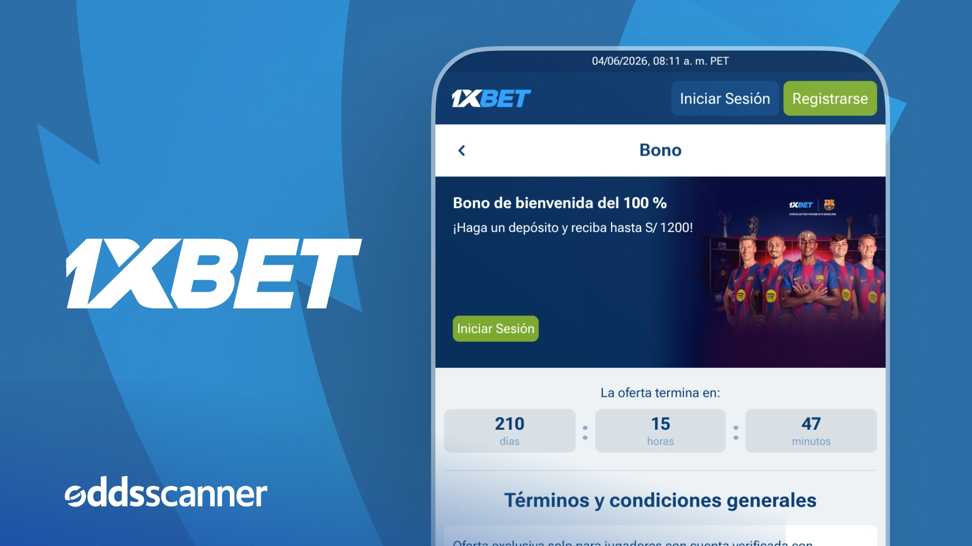 1xbet